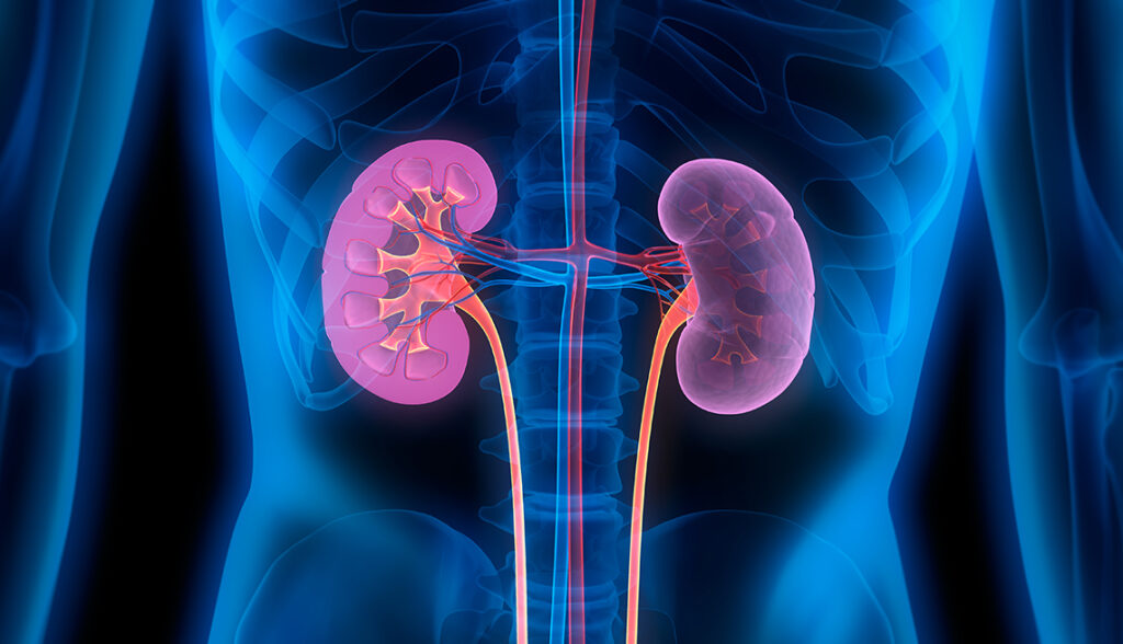 7 Foods that Actually Damage Your Kidneys